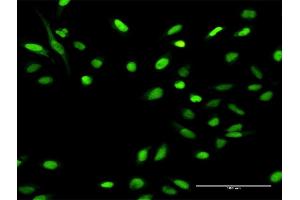 Immunofluorescence (IF) image for anti-Minichromosome Maintenance Deficient 4 (MCM4) (AA 1-863) antibody (ABIN950014)
