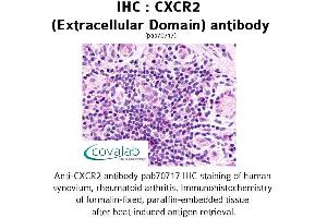 Image no. 1 for anti-Chemokine (C-X-C Motif) Receptor 2 (CXCR2) (2nd Extracellular Domain) antibody (ABIN1733394) (CXCR2 antibody  (2nd Extracellular Domain))