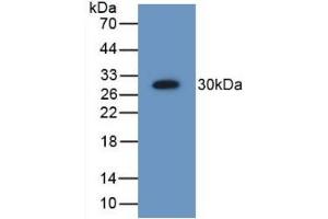 Detection of Recombinant PSMD9, Human using Polyclonal Antibody to Proteasome 26S Subunit, Non ATPase 9 (PSMD9) (Proteasome 26S Subunit, Non ATPase 9 (AA 2-223) antibody)