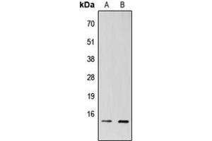 Western blot analysis of TAF13 expression in HEK293T (A), H9C2 (B) whole cell lysates. (TAF13 antibody  (Center))