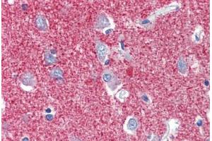 Human Brain, Cortex (formalin-fixed, paraffin-embedded) stained with SLC25A28 antibody ABIN462242 followed by biotinylated goat anti-rabbit IgG secondary antibody ABIN481713, alkaline phosphatase-streptavidin and chromogen. (SLC25A28 antibody  (AA 290-339))