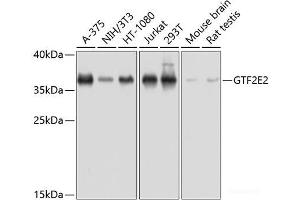 Western blot analysis of extracts of various cell lines using GTF2E2 Polyclonal Antibody at dilution of 1:1000. (GTF2E2 antibody)