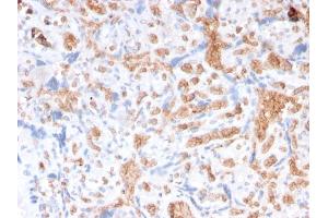 Formalin-fixed, paraffin-embedded human Placenta stained with Spectrin alpha 1 Mouse Recombinant Monoclonal Antibody (rSPTA1/1832). (Recombinant SPTA1 antibody  (AA 356-475))