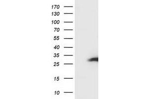 Image no. 4 for anti-Synovial Sarcoma, X Breakpoint 1 (SSX1) antibody (ABIN1501159) (SSX1 antibody)