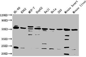 Western Blot Positive WB detected in: HL60 whole cell lysate, K562 whole cell lysate, MCF-7 whole cell lysate, HepG2 whole cell lysate, Raji whole cell lysate, Hela whole cell lysate, 293 whole cell lysate, Mouse heart tissue, Mouse liver tissue All lanes: NCR3LG1 antibody at 1:2000 Secondary Goat polyclonal to rabbit IgG at 1/50000 dilution Predicted band size: 51 kDa Observed band size: 51 kDa (B7-H6 antibody  (AA 25-262))