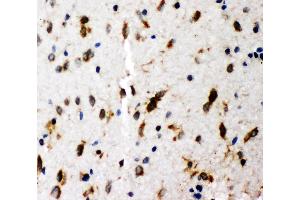 Immunohistochemistry (IHC) image for anti-SHC (Src Homology 2 Domain Containing) Transforming Protein 1 (SHC1) (AA 424-440), (C-Term) antibody (ABIN3044111)