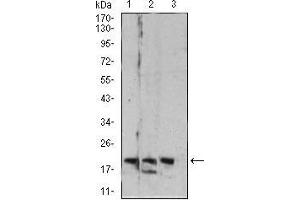 Western Blotting (WB) image for anti-RAB6B, Member RAS Oncogene Family (RAB6B) (AA 95-208) antibody (ABIN5542692)