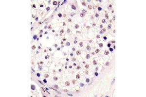(ABIN6242809 and ABIN6578637) staining MLL3 in human testis tissue sections by Immunohistochemistry (IHC-P - paraformaldehyde-fixed, paraffin-embedded sections). (MLL3 antibody  (N-Term))