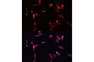 Immunofluorescence analysis of NIH/3T3 cells using MMP16 antibody (ABIN6132356, ABIN6143906, ABIN6143907 and ABIN6214654) at dilution of 1:100. (MMP16 antibody  (AA 290-565))