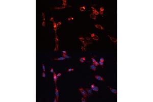 Immunofluorescence analysis of NIH/3T3 cells using MMP16 antibody (ABIN6132356, ABIN6143906, ABIN6143907 and ABIN6214654) at dilution of 1:100. (MMP16 antibody  (AA 290-565))