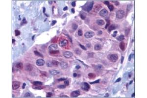 Image no. 1 for anti-BCL2 Binding Component 3 (BBC3) (N-Term) antibody (ABIN264889) (PUMA antibody  (N-Term))