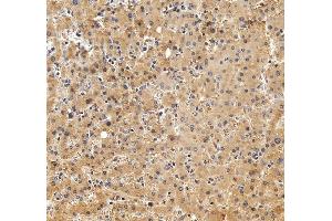 IHC analysis of Alpha 2-Antiplasmin/SERPINF2 using anti-Alpha 2-Antiplasmin/SERPINF2 antibody (ABIN7601808). (alpha 2 Antiplasmin antibody  (AA 461-491))