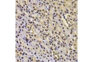 Immunohistochemistry of paraffin-embedded mouse kidney using FBXW7 antibody (ABIN5975397) at dilution of 1/100 (40x lens).