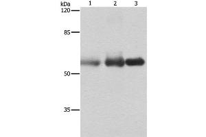 Western Blot analysis of Human cervical cancer, legs fibrous histiocytoma and fetal brain tissue using NECTIN1 Polyclonal Antibody at dilution of 1:400 (PVRL1 antibody)