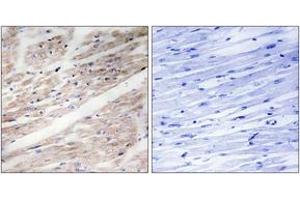 Immunohistochemistry analysis of paraffin-embedded human heart, using KIT (Phospho-Tyr936) Antibody. (KIT antibody  (pTyr936))