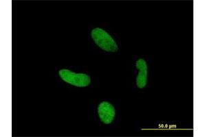 Immunofluorescence of purified MaxPab antibody to ZNF287 on HepG2 cell. (ZNF287 antibody  (AA 1-754))