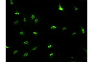 Immunofluorescence of monoclonal antibody to DLX3 on HeLa cell. (DLX3 antibody  (AA 1-287))