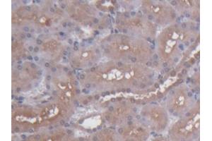 DAB staining on IHC-P; Samples: Rat Kidney Tissue (S100 Protein (S100) (AA 1-94) antibody)