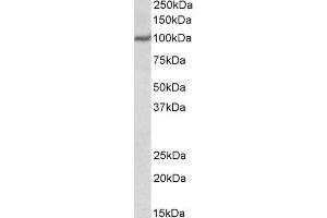 Approx 100kDa band observed in Human Heart lysates (calculated MW of 104kDa according to NP_955475. (USP4 antibody  (N-Term))