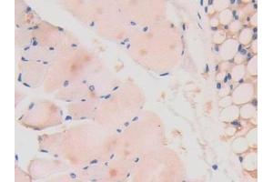 Detection of LAMa4 in Mouse Skeletal muscle Tissue using Polyclonal Antibody to Laminin Alpha 4 (LAMa4) (LAMa4 antibody  (AA 745-940))