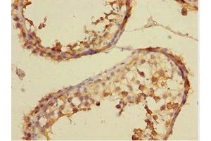 Immunohistochemistry of paraffin-embedded human testis tissue using ABIN7149072 at dilution of 1:100 (CSRNP2 antibody  (AA 324-543))