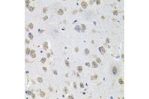 Immunohistochemistry of paraffin-embedded mouse brain using GNE antibody at dilution of 1:100 (x40 lens). (GNE antibody)