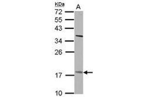 Image no. 2 for anti-Patatin-Like phospholipase Domain Containing 4 (PNPLA4) (AA 1-249) antibody (ABIN1500317)
