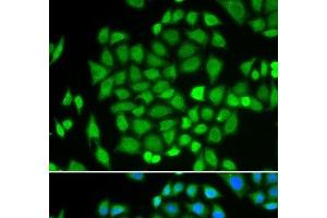 Immunofluorescence analysis of HeLa cells using AKR7A2 Polyclonal Antibody (AKR7A2 antibody)