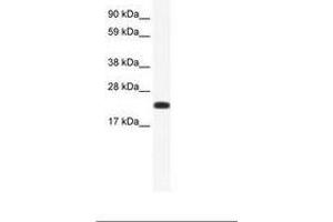 Image no. 1 for anti-Cbp/p300-Interacting Transactivator, with Glu/Asp-Rich Carboxy-terminal Domain, 4 (CITED4) (AA 31-80) antibody (ABIN202045) (CITED4 antibody  (AA 31-80))