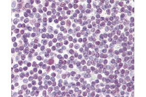 Anti-DDX18 antibody IHC of human tonsil. (DDX18 antibody  (AA 20-70))