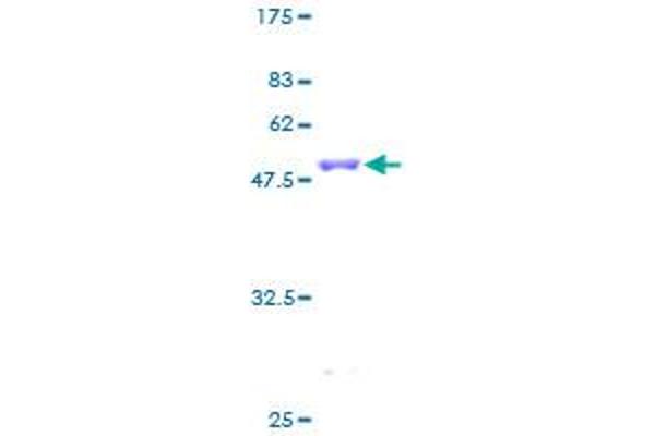CBFB Protein (AA 1-182) (GST tag)