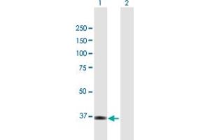 Western Blot analysis of TNK2 expression in transfected 293T cell line by TNK2 MaxPab polyclonal antibody. (TNK2 antibody  (AA 1-352))