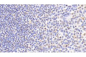 Immunohistochemistry (IHC) image for anti-Nucleophosmin (Nucleolar phosphoprotein B23, Numatrin) (NPM1) (AA 20-154) antibody (ABIN7435076)