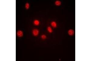 Immunofluorescent analysis of c-Jun staining in HeLa cells. (C-JUN antibody)