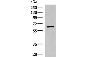 Western blot analysis of Human placenta tissue lysate using PDIA5 Polyclonal Antibody at dilution of 1:1000 (PDIA5 antibody)