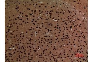 Immunohistochemistry (IHC) analysis of paraffin-embedded Mouse Brain, antibody was diluted at 1:100. (CDH6 antibody  (Internal Region))