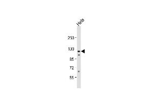 Anti-VINC Antibody (C-term) at 1:1000 dilution + Hela whole cell lysate Lysates/proteins at 20 μg per lane. (Vinculin antibody  (C-Term))