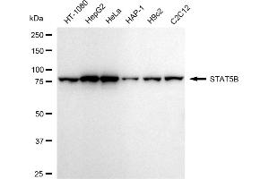 Western blotting analysis using STAT5B antibody (ABIN7800348). (Recombinant STAT5B antibody)