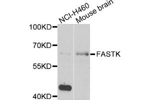 Western blot analysis of extracts of NCI-H460 and mouse brain cells, using FASTK antibody.