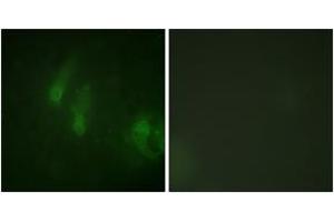 Immunofluorescence analysis of HeLa cells, using FANCA (Phospho-Ser1149) Antibody. (FANCA antibody  (pSer1149))