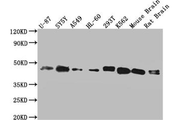 SPPL3 Antikörper  (AA 213-263)