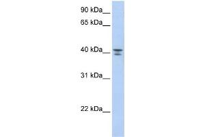 WB Suggested Anti-GNA12 Antibody Titration: 0. (GNA12 antibody  (Middle Region))