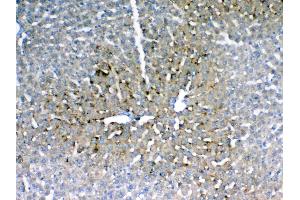 IHC analysis of IGFBP1 using anti-IGFBP1 antibody . (IGFBPI antibody  (AA 26-272))