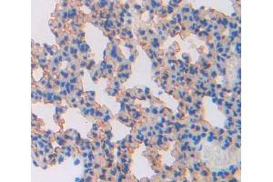 Used in DAB staining on fromalin fixed paraffin- embedded lung tissue (ABCA8 antibody  (AA 1303-1514))