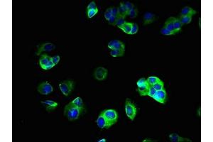 Immunofluorescent analysis of MCF-7 cells using ABIN7171103 at dilution of 1:100 and Alexa Fluor 488-congugated AffiniPure Goat Anti-Rabbit IgG(H+L) (SV2B antibody  (AA 1-108))