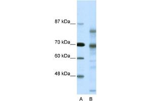WB Suggested Anti-NCOR2 Antibody Titration:  0.