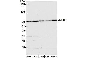 Western Blotting (WB) image for anti-Fused in Sarcoma (FUS) (AA 1-50) antibody (ABIN7454969)