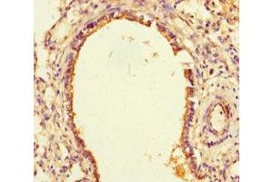 Immunohistochemistry of paraffin-embedded human lung tissue using ABIN7169807 at dilution of 1:100 (SLITRK6 antibody  (AA 621-821))