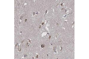 ABIN6266655 at 1/100 staining human brain tissue sections by IHC-P. (PIAS3 antibody  (N-Term))