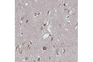ABIN6266655 at 1/100 staining human brain tissue sections by IHC-P. (PIAS3 antibody  (N-Term))